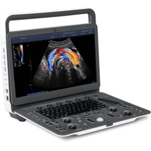 Ecograf portabil SonoScape E2- cu sonda liniară L741